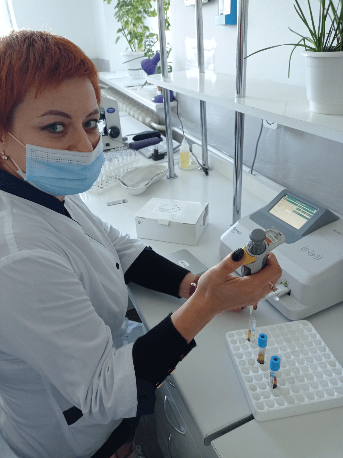 D-димер – новий метод оцінки ризику тромбозів